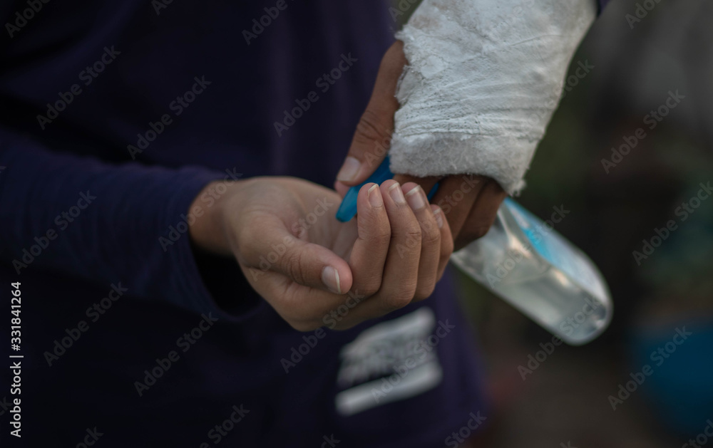 Closeup of a coronavirus infected  man disinfecting his hands with alcohol hand sanitizer from a bottle.Selective focus