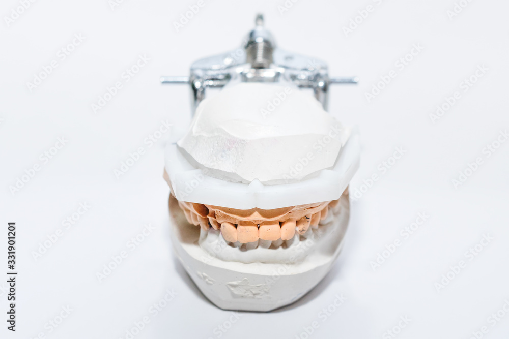 Plaster Cast of jaws. Dental casting gypsum model human Jaws in