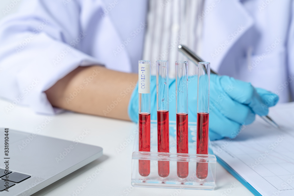 Doctor with covid-19 are test sample tube with coronavirus in lab. Doctor with covid-19 are test sample tube with coronavirus in lab.