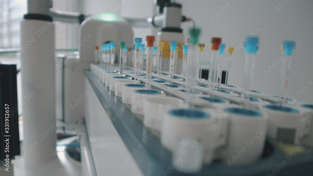 Closeup of tubes in a scientific laboratory. Coronavirus infected patients' samples taken for medical examination and COVID-19 diagnostics. Closeup of tubes in a scientific laboratory. Coronavirus infected patients' samples taken for medical examination and COVID-19 diagnostics.
