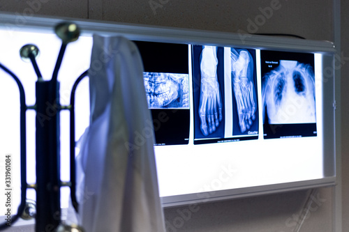 Radiographies sur négatoscope allumé pour lecture avec porte manteau et blouse blanche photo