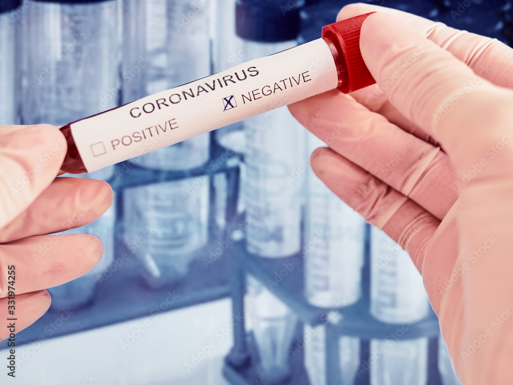Corona virus. Coronavirus 2019-nCoV Blood Test. Pandemic virus China.
