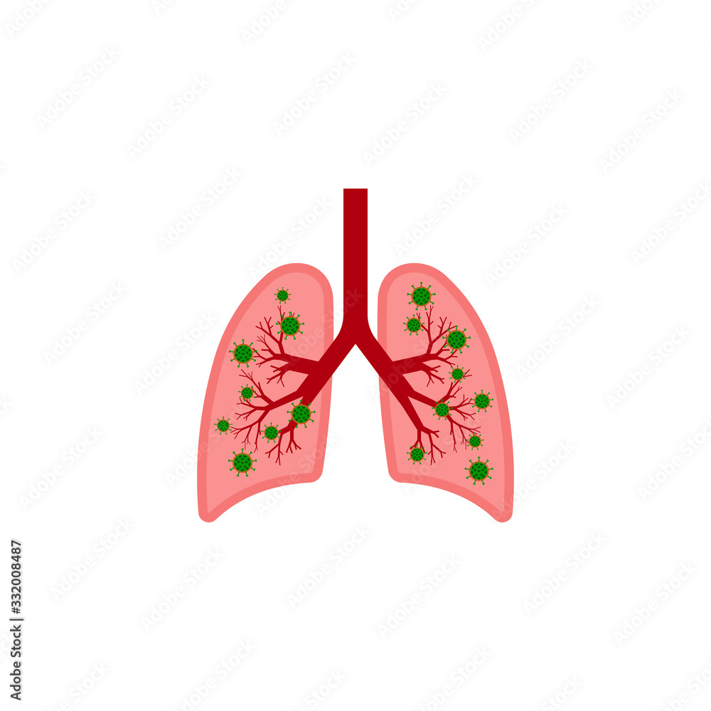 Lungs disease icon. COVID-19 in human lungs. Vector illustration. Flat design. Lungs disease icon. COVID-19 in human lungs. Vector illustration. Flat design.
