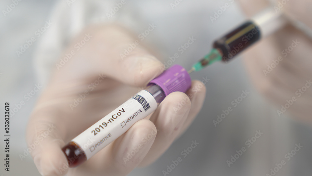 Başlık: A doctor takes blood with syringe for coronavirus Covid-19 test in lab. Başlık: A doctor takes blood with syringe for coronavirus Covid-19 test in lab.