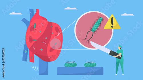 Cardiology treatment by surgeon. This disease calls endocarditis. It is infection of endocardium that is inner heart chambers and valves. Bacteria, parasite and virus are running to blood vessel.