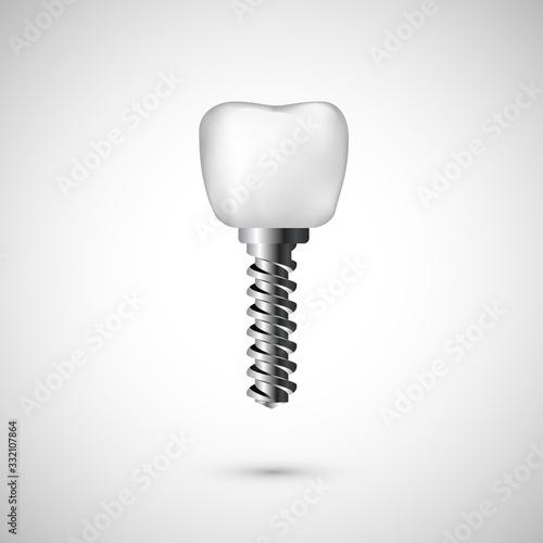 White realistic tooth implant illustration. Dentist care and tooth restoration medicine background on white background. Vector