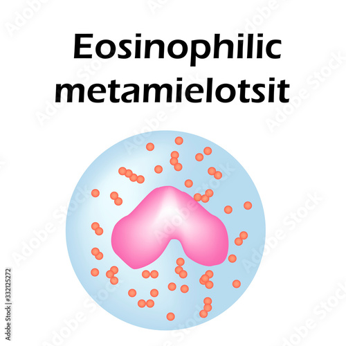 Eosinophil structure. Eosinophil blood cells. White blood cells. Metamyelocytes leukocytes. Infographics. Vector illustration on isolated background. photo