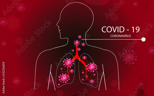 Coronavirus disease COVID-19 infection medical illustration.pathogen respiratory influenza covid virus cells. New official name for Coronavirus disease named COVID-19