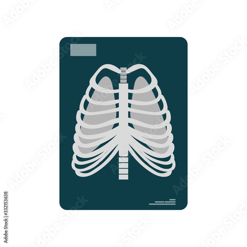 Vector illustration of a snapshot of the lungs. X-ray of the lungs isolated on a white background.