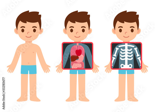 Cartoon child x-ray