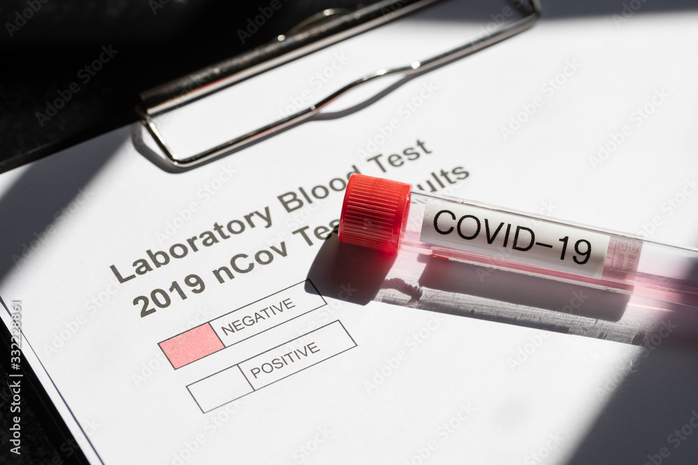 Obraz premium Laboratory Testing for nCovid-19 Corona Virus 2019-2020