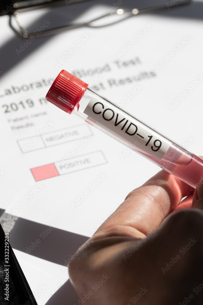 Fototapeta premium Laboratory Testing for nCovid-19 Corona Virus 2019-2020