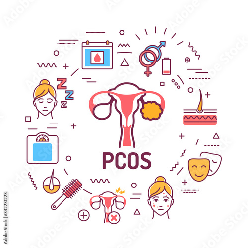 PCOS symptoms web banner. Female reproductive system disease. Infographics with linear icons on red background. Isolated outline color illustration.