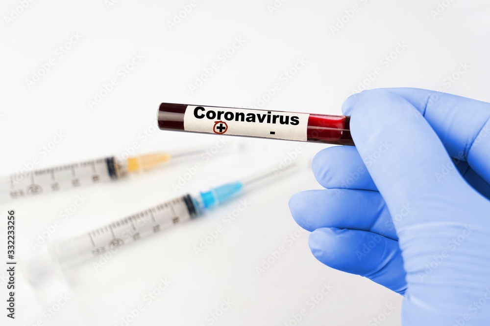 Obraz premium Coronavirus , medical conceptual image .