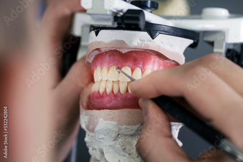 dental technician creates removable dental prostheses with pink gum photo