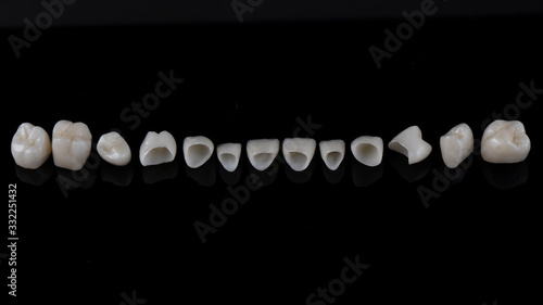 beautifully laid out veneers and crowns for the entire jaw of the patient, shot on a black background