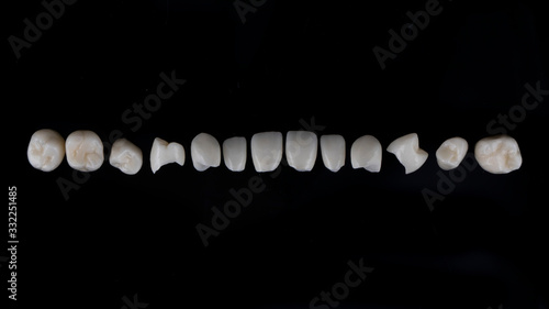 excellent composition of ceramic crowns for the entire jaw, shot from above on a black background