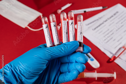 Test tube with blood for analysis 2019-nCoV. New concept of Chinese coronavirus blood test.