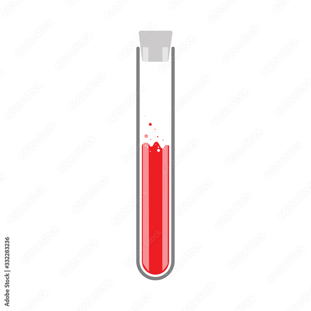 Tube with blood for coronavirus 2019-nCoV analyzing. Tube with blood for coronavirus 2019-nCoV analyzing.