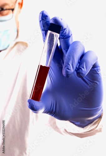 Doctor, laboratory practitioner holding a test tube with a blood sample. Corona. Coronavirus test.