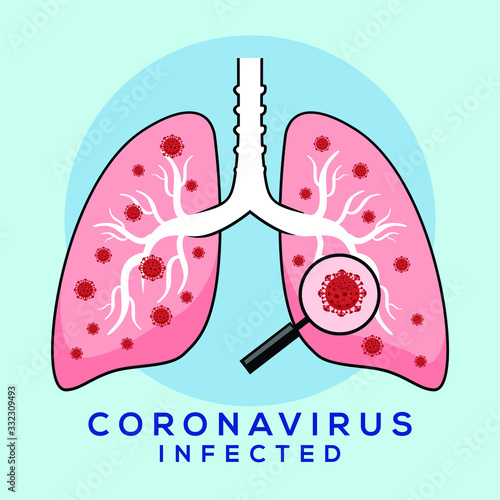 Coronavirus Infected Lungs Disease Covid 19