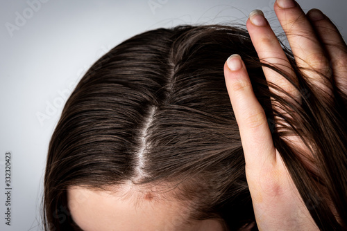 Valokuva Young woman with dirty greasy hair on gray background.