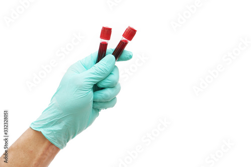 Hand of doctor holding blood sampling in laboratory