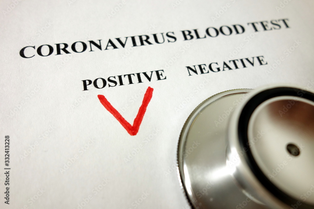 Positive blood test result for Coronavirus, Covid-19 diagnosis concept Positive blood test result for Coronavirus, Covid-19 diagnosis concept