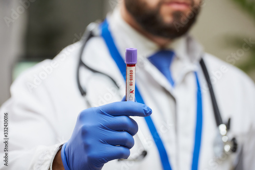 An infectious disease physician with a beard demonstrating a coronavirus blood sample in his hand. A close-up photo of a positive COVID-19 blood tube test.