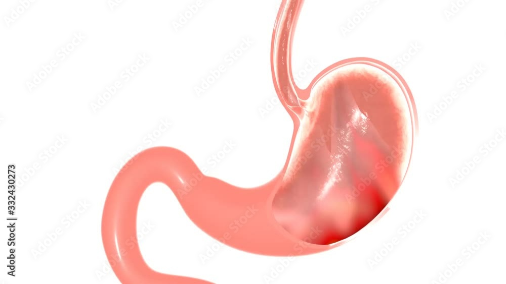 Anatomical 3D animation of heartburn. Graphical representation of the effect, enlarging the image isolated on white background. Anatomical 3D animation of heartburn. Graphical representation of the effect, enlarging the image isolated on white background.