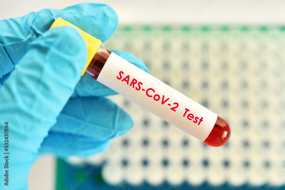 Test tube with blood sample for SARS-CoV-2 or COVID-19 virus test Test tube with blood sample for SARS-CoV-2 or COVID-19 virus test