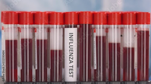 Hand wearing protection glove puts vial with influenza test in the tube rack photo