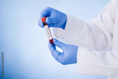 Corona Virus in Lab. Scientist hold Blood Test. New Epidemic Coronavirus 2019 nCoV