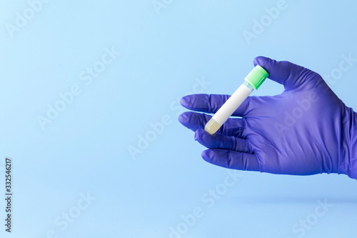 test tube in hand of lab technician