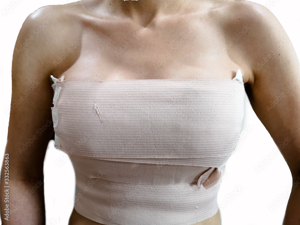 Beautiful Woman With Bandaged Breasts With Markings After Plastic
