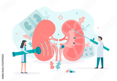 Treatment of urolithiasis. Doctors perform lithotripsy. Removal of kidney stones. Medical concept with tiny people. Flat vector illustration.