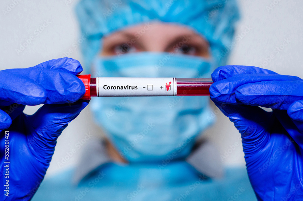 Medical laboratory assistant holding test tube with positive Coronavirus test blood sample. Medical laboratory assistant holding test tube with positive Coronavirus test blood sample.