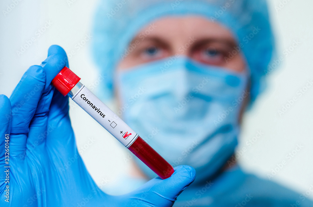 Medical laboratory assistant holding test tube with positive Coronavirus test blood sample. Medical laboratory assistant holding test tube with positive Coronavirus test blood sample.