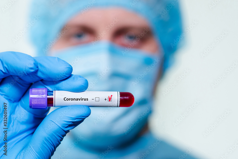 Medical laboratory assistant holding test tube with positive Coronavirus test blood sample. Medical laboratory assistant holding test tube with positive Coronavirus test blood sample.
