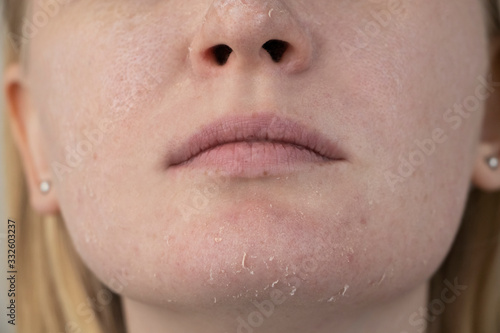 Fényképezés A woman examines dry skin on her face
