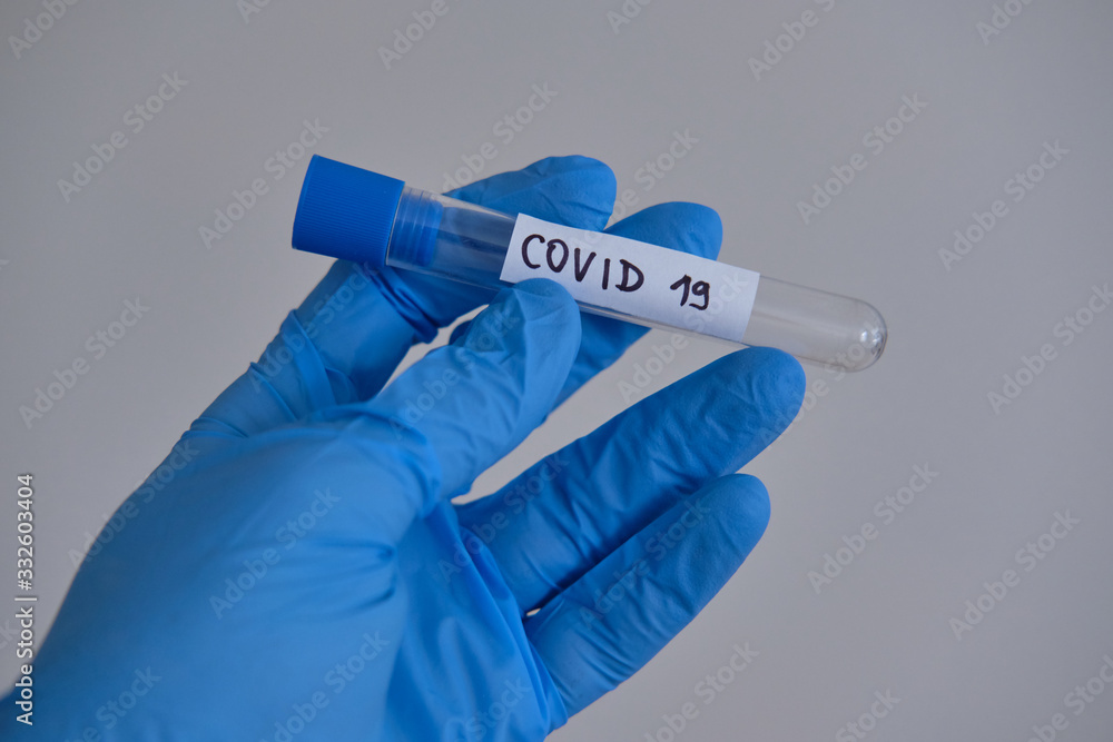 Obraz premium Test tube prepared for coronavirus test of patient suspect for COVID-19 disease.