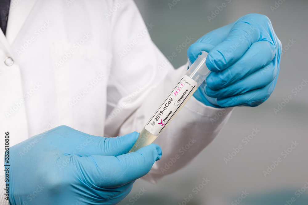 hand in blue gloves holding a test tube after virus analysis with positive result markers in front of a lab room hand in blue gloves holding a test tube after virus analysis with positive result markers in front of a lab room