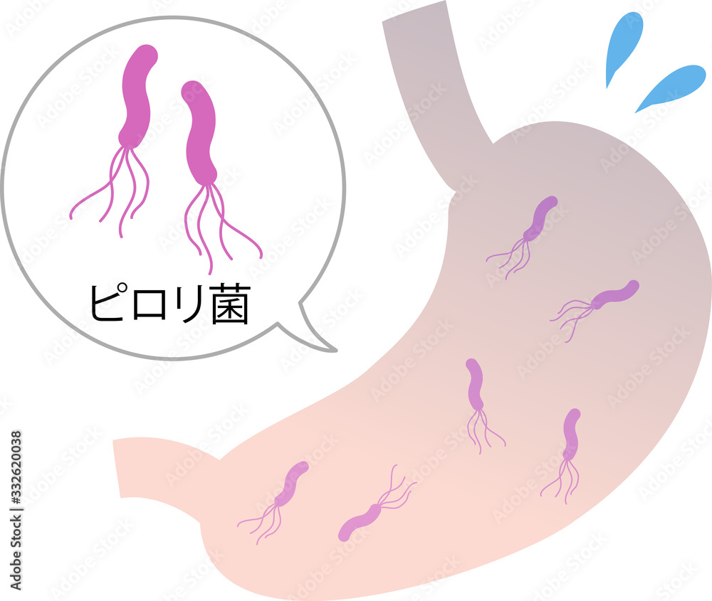 ピロリ菌 胃 イメージイラスト Stock Vector Adobe Stock