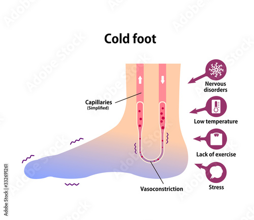 Cold foot blood circulation illustration (sensitivity to cold, cold toes)