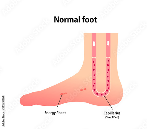 Normal foot blood circulation illustration