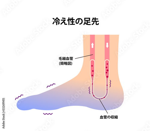 末端冷え性の足 イラスト (冷え性の原因)