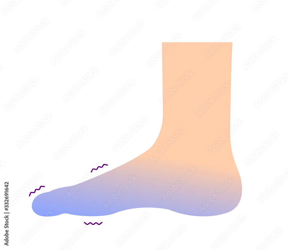 Cold hand blood circulation illustration (sensitivity to cold, cold toes) Cold hand blood circulation illustration (sensitivity to cold, cold toes)