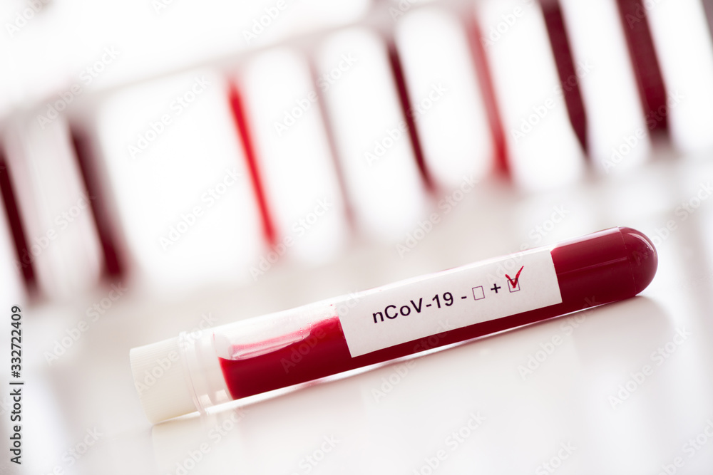 Test tube with blood sample for COVID-19 test, novel coronavirus 2019. Concept of vaccination, Covid-19 coronavirus diagnostic, cure for the flu virus Test tube with blood sample for COVID-19 test, novel coronavirus 2019. Concept of vaccination, Covid-19 coronavirus diagnostic, cure for the flu virus