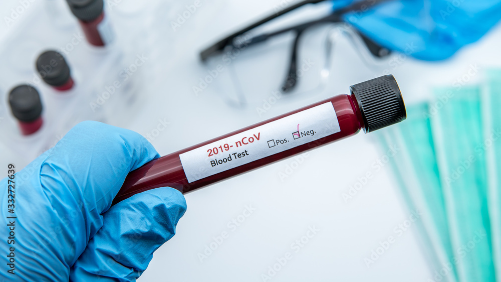 Test tube with negative blood sample for COVID-19, coronavirus from Wuhan Test tube with negative blood sample for COVID-19, coronavirus from Wuhan