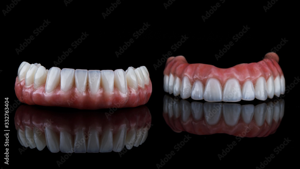 beautiful dental prosthesis for the lower jaw in the foreground, shot on a black background with reflection beautiful dental prosthesis for the lower jaw in the foreground, shot on a black background with reflection